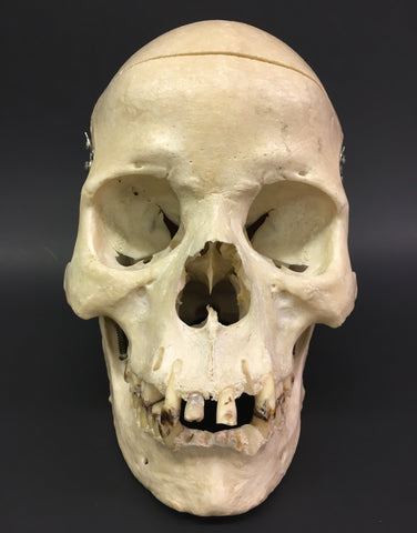 Authentic Human Skull - Medical Teaching Specimen #1
