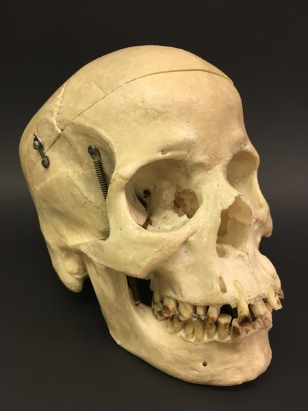 Authentic Human Skull - Medical Teaching Specimen #1