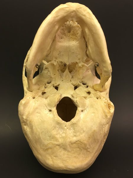 Authentic Human Skull - Medical Teaching Specimen #1
