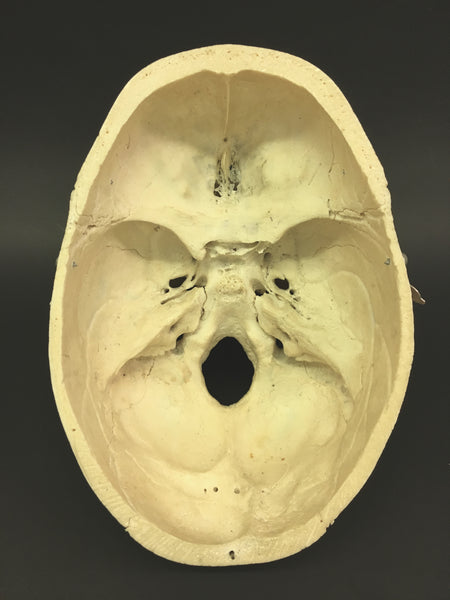 Authentic Human Skull - Medical Teaching Specimen #1