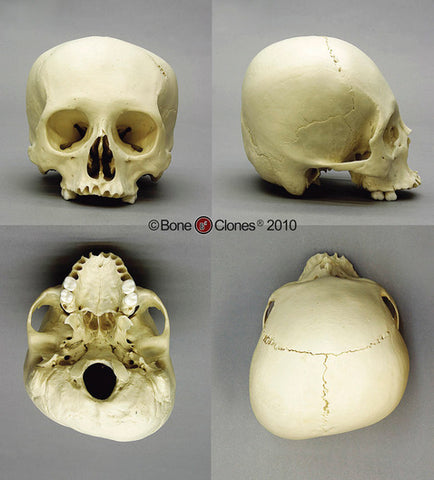 Historic Skull: Cast Replica Human Female Cradle Boarded Skull - Homo sapiens #BC-222