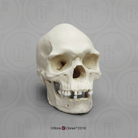 Human Skull (Australian Aboriginal male) Cast Replica - Homo sapiens #BC-031