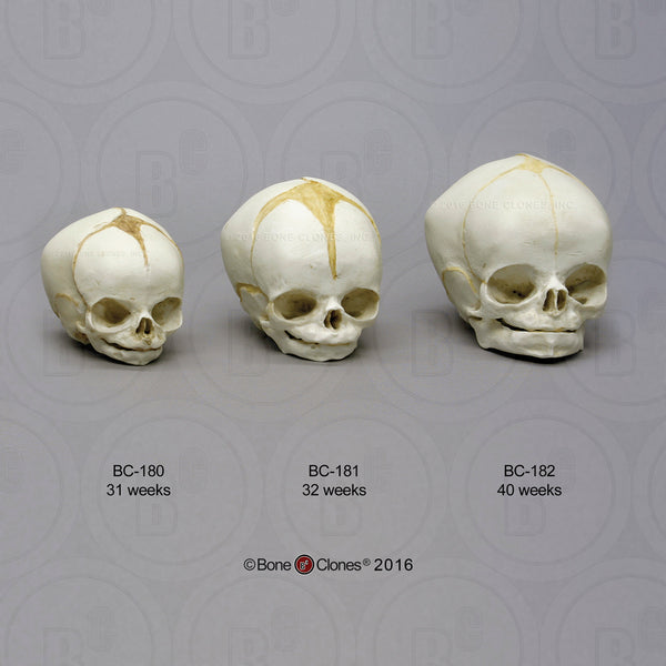 Human Fetal Skulls (set of 3) Cast Replicas - Homo sapiens #BC-182-Set