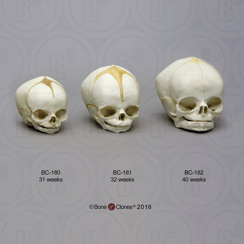 Human Fetal Skulls (set of 3) Cast Replicas - Homo sapiens #BC-182-Set