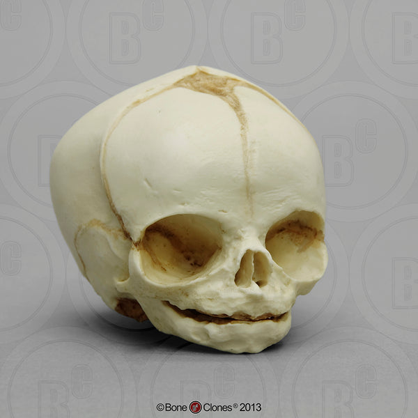 Human Fetal Skulls (set of 3) Cast Replicas - Homo sapiens #BC-182-Set