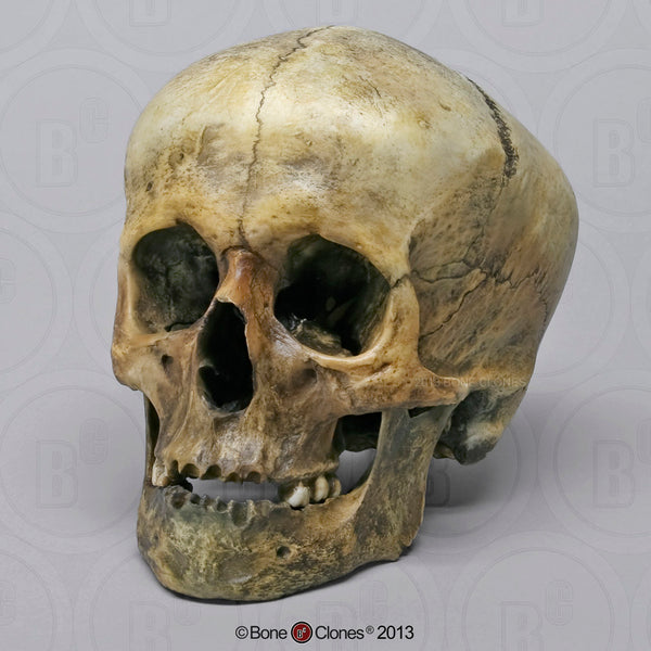 Historic Skull: Cast Replica Gladiator Human Skull - Homo sapiens #BC-198